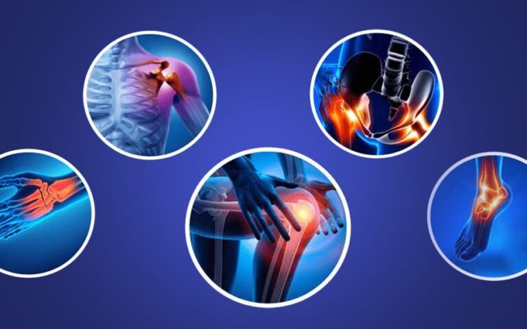 Understanding Common Orthopedic Conditions and Their Treatments